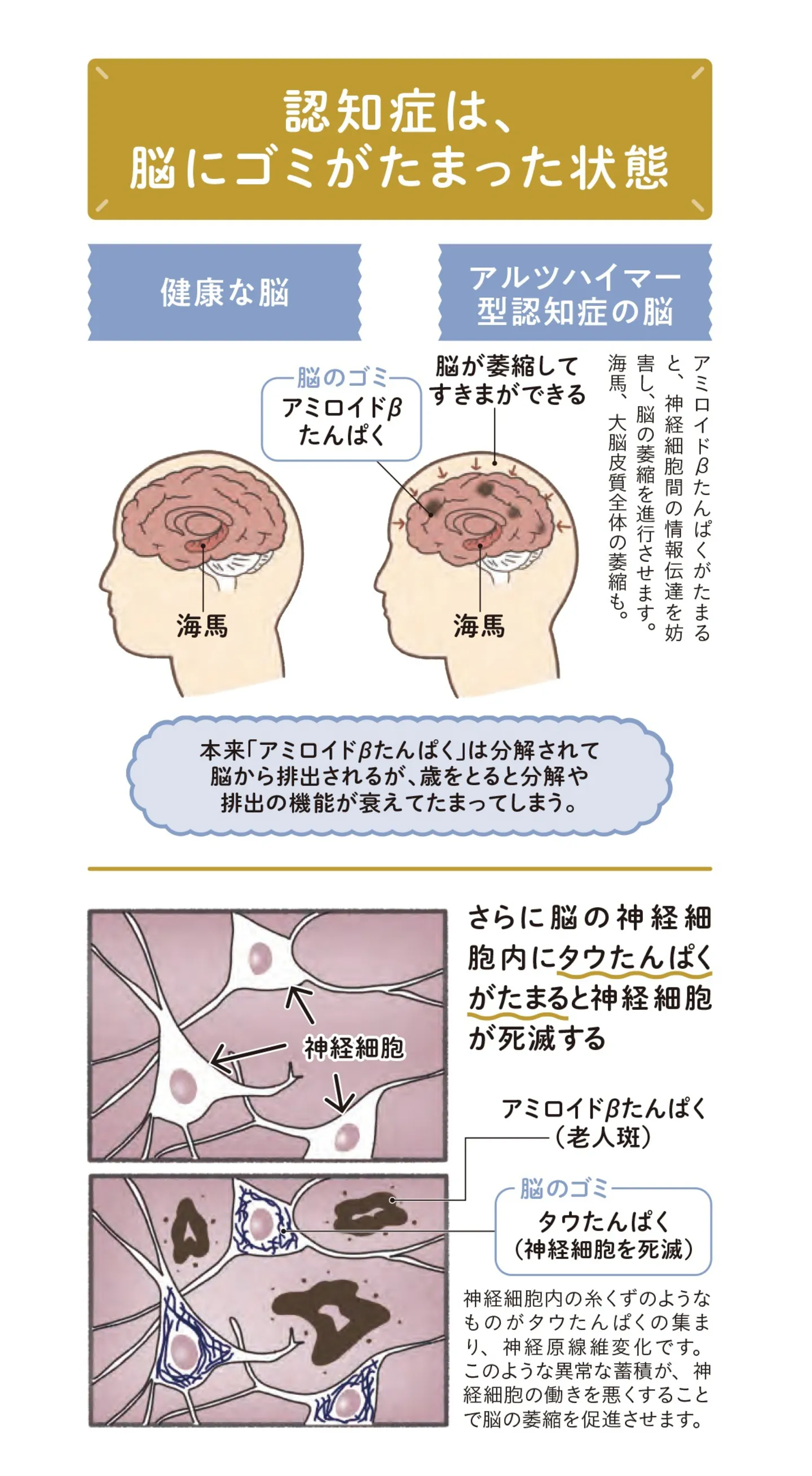 n_ 20241127_認知機能改善30秒スクワット-5
