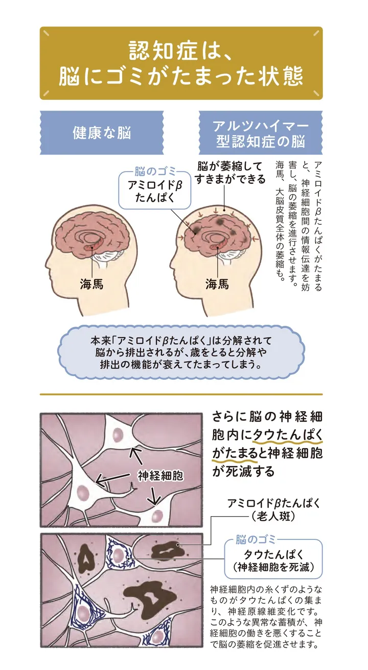 n_ 20241127_認知機能改善30秒スクワット-5