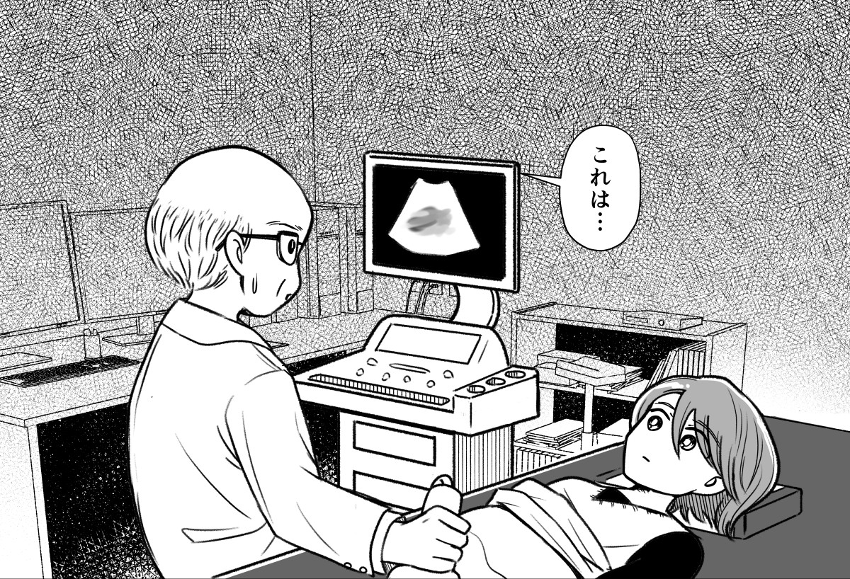わたしが選んだ死産の話